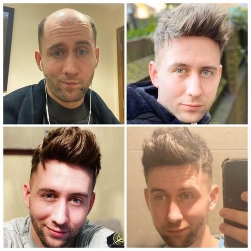 第一次买假发前，这几点一定要考虑清楚，不然容易踩坑