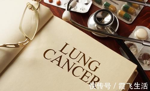 剂量|肺癌早发现，治愈率并不低！但普通体检办不到，要加1项检查