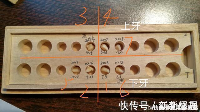 六龄齿|送给孩子正在换牙的父母们，你们一直都做错了什么？