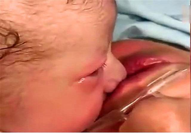 妈妈|宝妈分娩后昏迷，刚出生的“天使宝宝”亲吻妈妈，医生潸然落泪