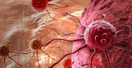 增生|癌症并非突如其来身上这5个不起眼的小症状，早已通知你