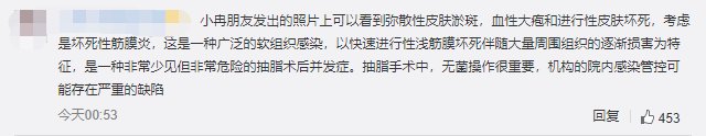 icu|33岁网红传死讯！为变美抽脂后全身感染，在ICU熬了两个月后死亡...官方最新通报→