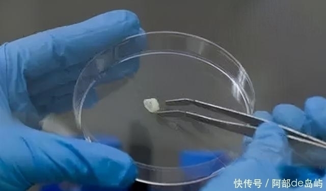 国际分子科学杂志|惊!小小乳牙竟能治疗多种疾病?爸爸妈妈别再丢掉它