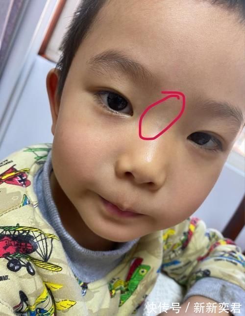 忌口|孩子积食后,这3种食物要忌口,若不注意,脾胃会“水泄不通”