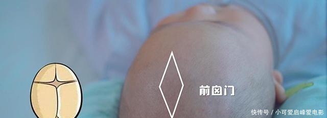 宝出生以后|囟门闭合的时间,对大脑发育有什么影响如果是第三种就该注意了