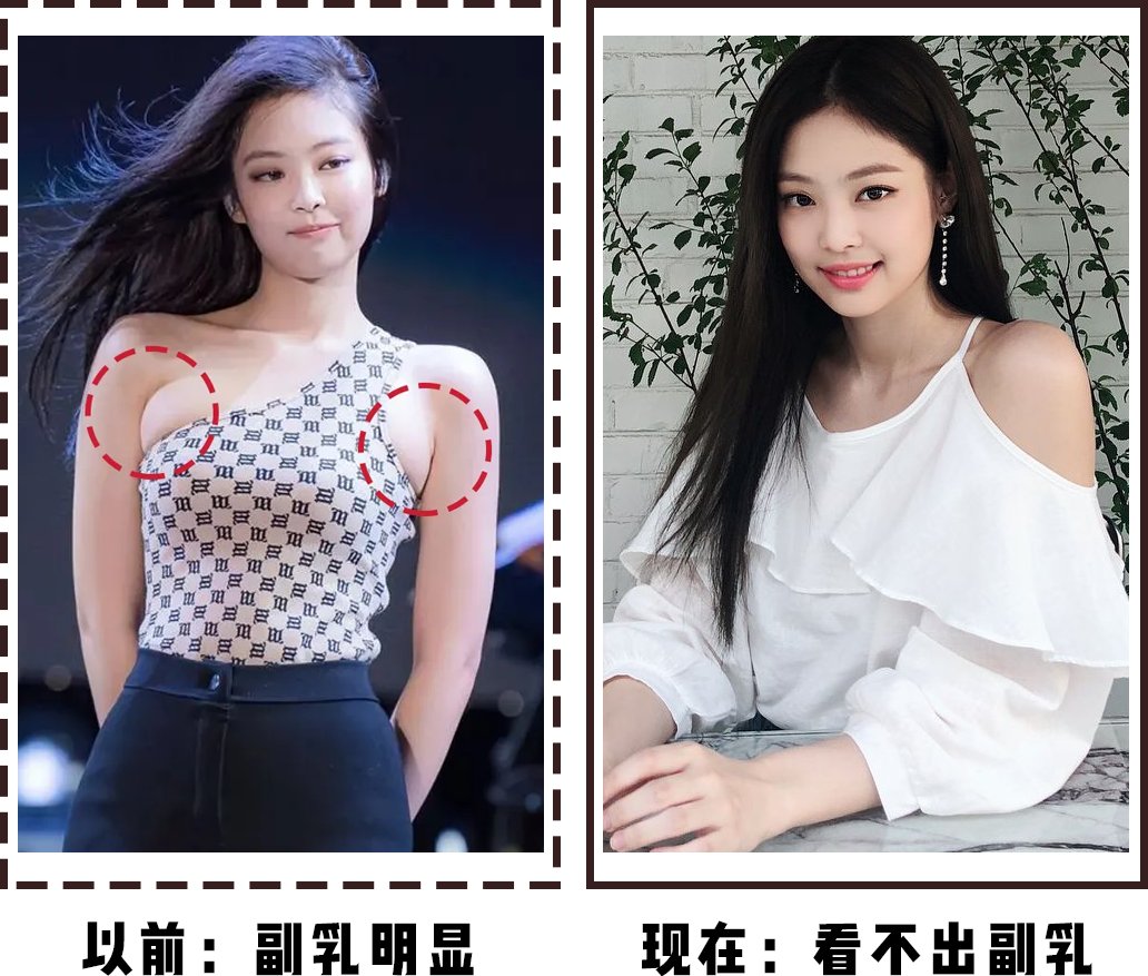 副乳|女生买夏装，怎么才能不踩雷？