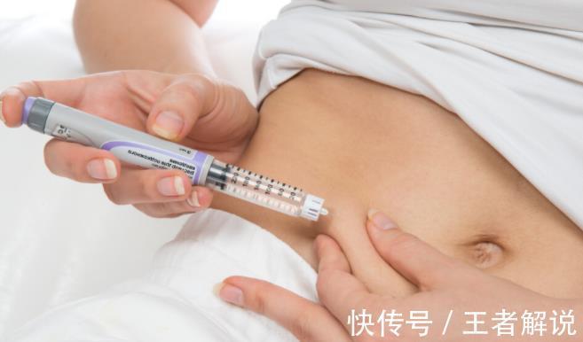 糖尿病患者|专家:如何解决糖尿病人的“黎明现象”