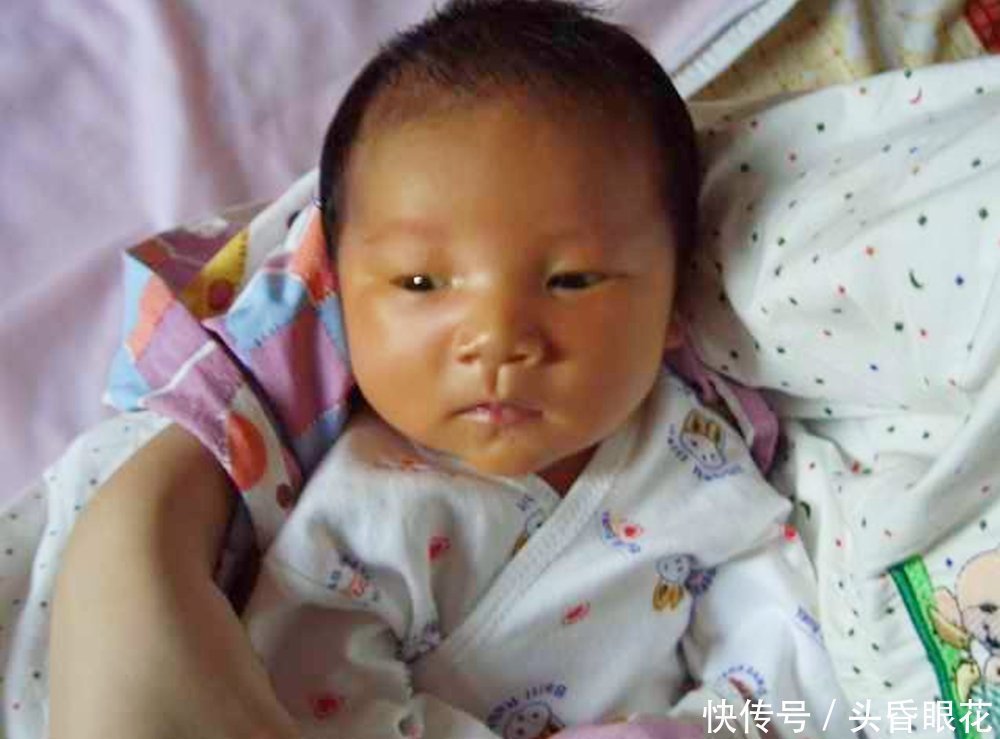 早产儿|不想孩子生下来有“黄疸”,这3类食物,孕妇再馋也要管住嘴!