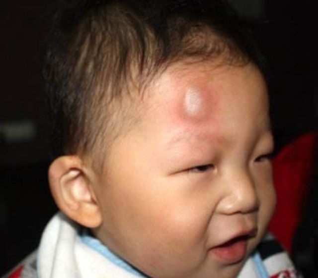 强强|1岁宝宝摔下床，妈妈的做法让婆婆直呼冷血，医生却说：做的对