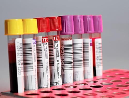 血常规|血常规可以看出是否患有癌细胞吗?听医生怎么说,不妨了解一下