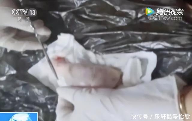 女孩|被整容毁掉的女孩“我的整形医生,只给鸡腿做过手术”