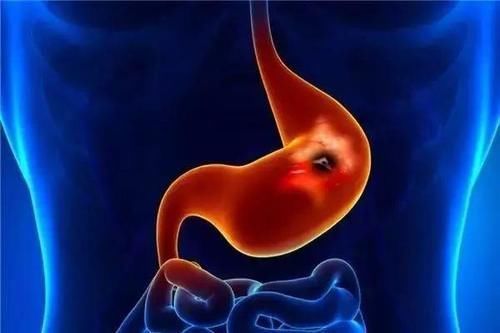 酒精|长期喝酒的人，建议“三不宜”，酒后“三不做”，你做到了吗