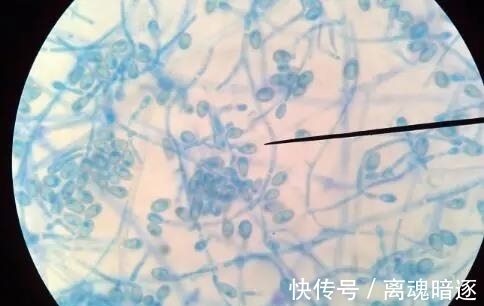 宠物|孩子头上长猫藓怎么办?