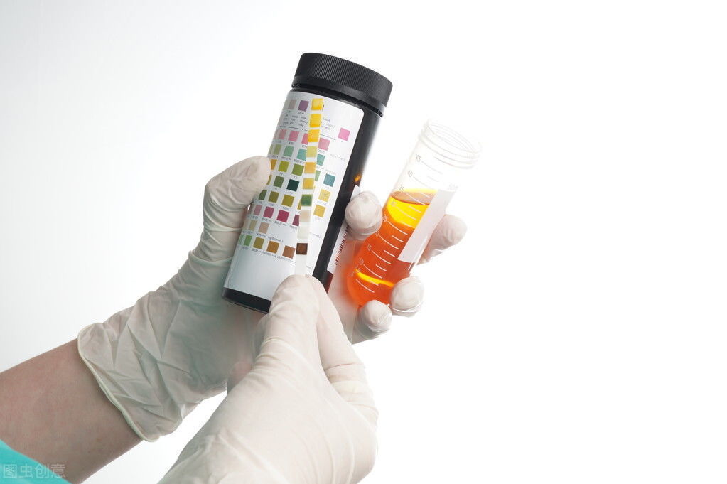 糖尿病|一“尿”知肾，糖尿病患者：抬头看糖，低头看尿