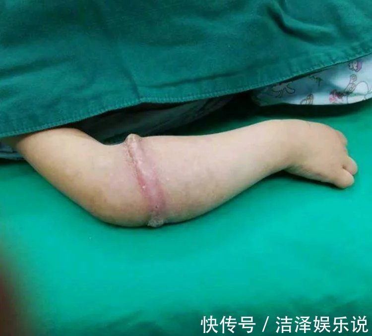 医生|4岁女孩得怪病,医生检查后,忍不住训斥父母心真大