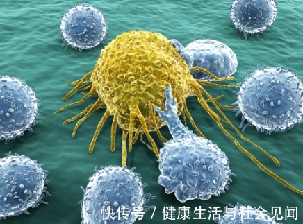 肺癌|哪些癌症最好治？为什么癌症难治？治疗癌症有哪些方法？