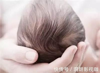 胎毛|宝宝胎毛什么时候剃最好医生不是满月不是百日,家长不要弄错