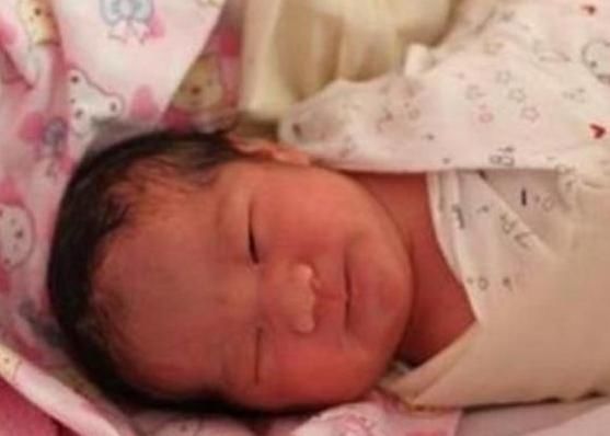 孩子|宝宝出生7天后迟迟不“睁眼”,父母送去医院,医生忍不住笑了