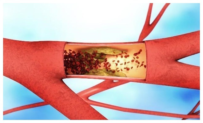 天然|“天然化栓王”被发现了，每天吃上几颗，可能会清肠道、降血栓