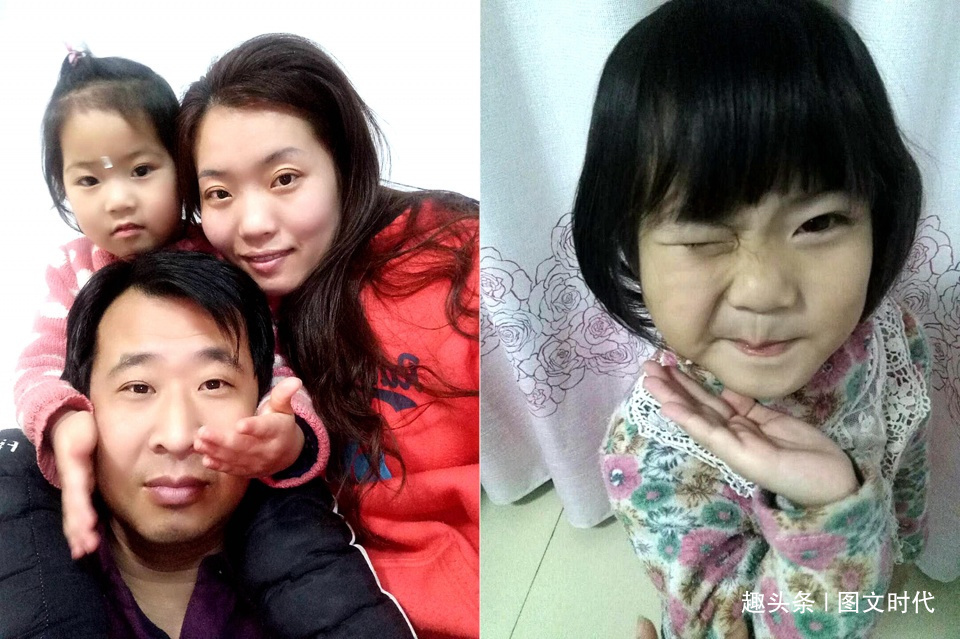 程程|6岁女童鼻子突然红肿,送医查出罕见肿瘤,妈妈含泪打掉腹中胎儿