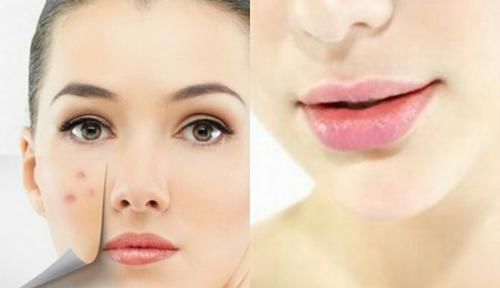 为何下巴长了很多小疙瘩？教你2个实用方法，快速去除小疙瘩