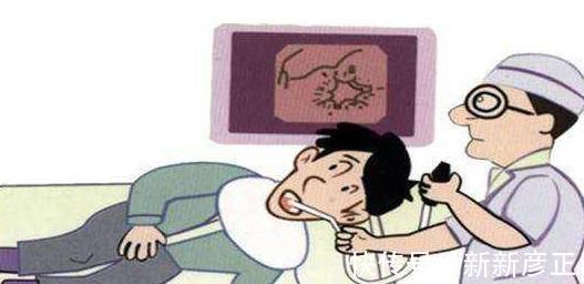 胸片|癌癥為什么一發現就是晚期，專家六個部位最好每年體檢一次