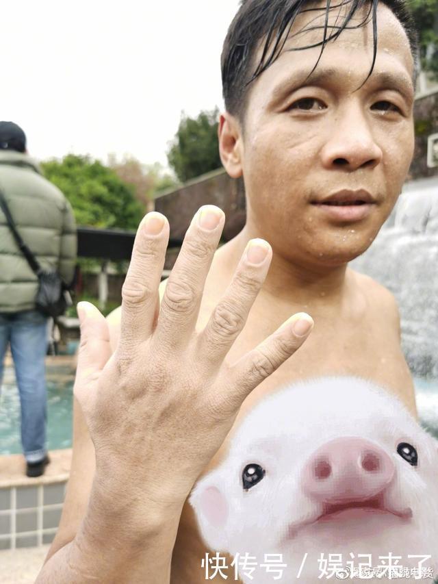 为了美白在脸上戳了900针,女明星为了美有多疯!