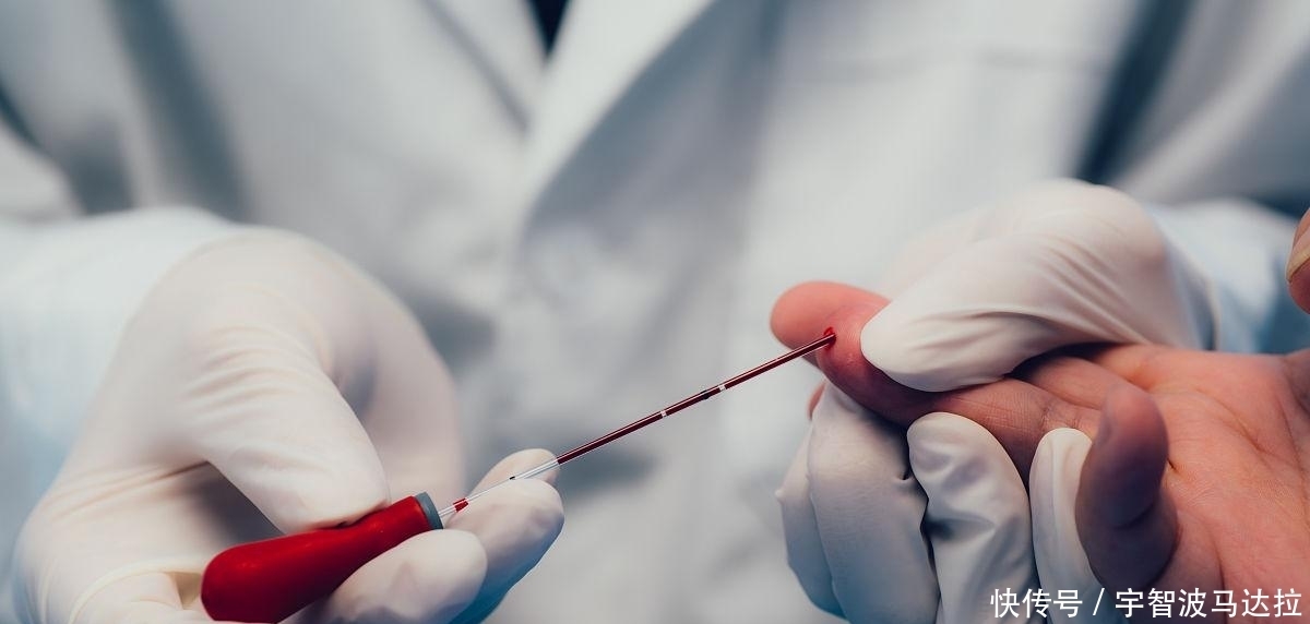 被称为肠道蠕动的加速器的1种菜,降脂、减肥,昨天你刚吃过