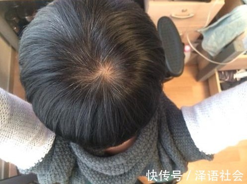 营养物质|人未老先“白头”,老中医玄秒的“偏方”,一用白发立生乌发