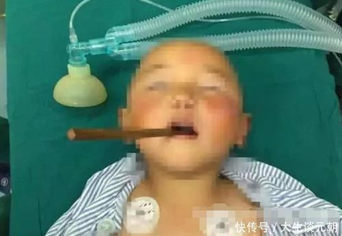 爸爸|儿子误将502滴入眼中,爸爸“教科书式”方法救了孩子,医生:高明