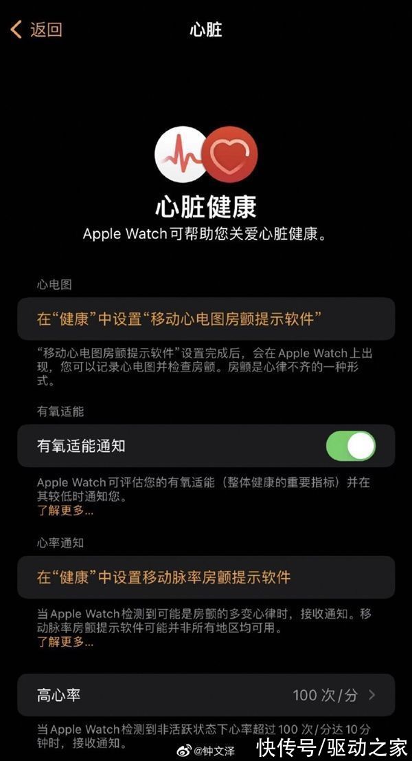 w国行Apple Watch终于获得“完全体”！ECG心电图已上线测试版系统