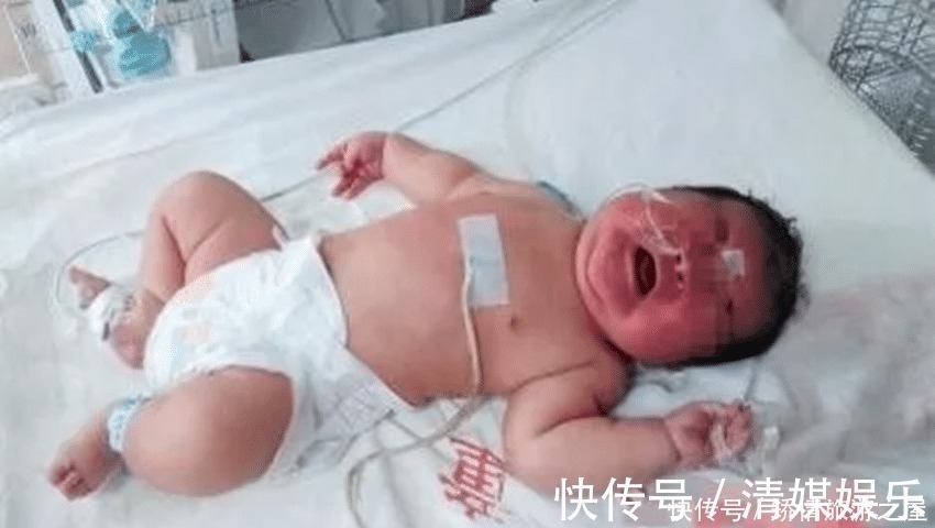 男宝|11斤重的男宝出生七天后，一直都没睁眼，医院检查后，全家人乐了