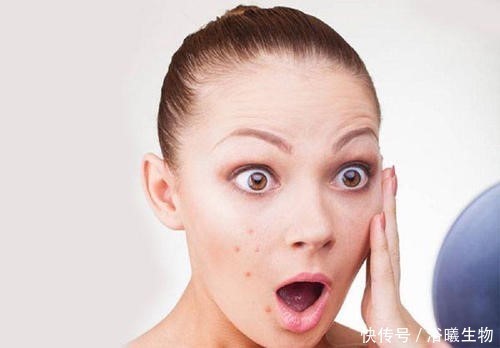 痘痘|长痘期间触碰这些禁忌,痘痘永远伴随你!