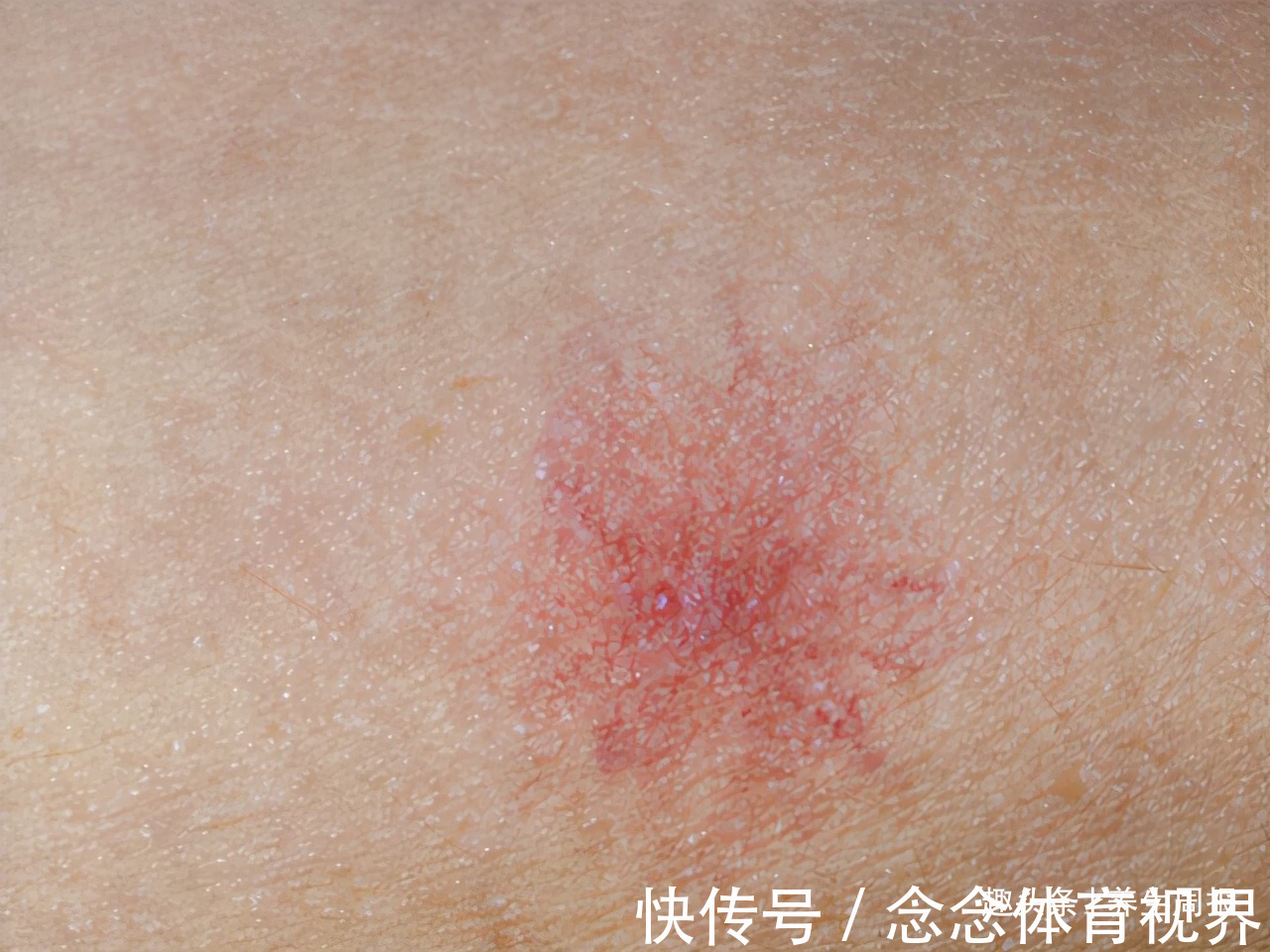 孙大爷|55岁大爷,从肝硬化到肝功正常,医生:常吃1“酸”,一点不难