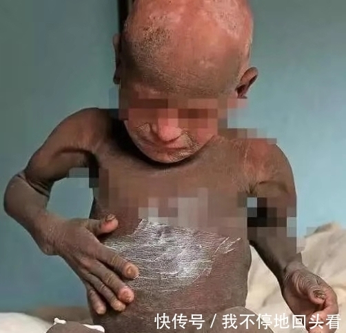 男孩|男孩越长越像“石孩”,去医院检查后,怒骂其父母丢人现眼!