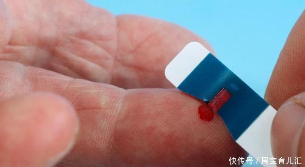 医生|血糖高的人,一点水果不能吃吗?医生坦言:3水果可多吃,不升糖