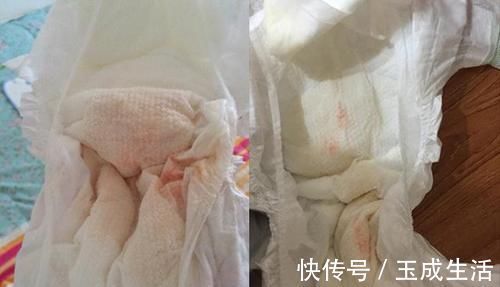 现象|“妹妹流血啦,妈妈快来”,面对意外,哥哥的反应让医生竖起拇指