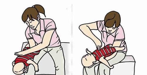 损伤|妈妈为“省事”,用这个喂奶,导致15个月女童大脑损伤