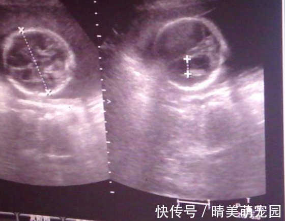 羊水|胎儿在母亲肚子里,生活的很“精致”,那他的大小便都去哪了?