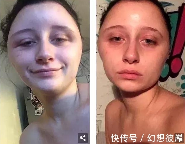 奇闻|奇闻:女孩自己动手染发变成“灯泡脸”,这就是美丽付出的代价