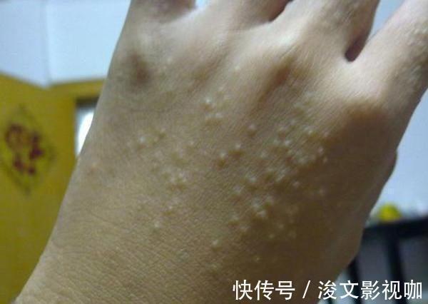 竖棱|肾不好的人, 手上3个表现“出卖你”, 很容易看出来