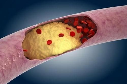 高血脂|血脂高夏天不能吃葡萄？提醒：想降脂的人，这3种水果可常吃