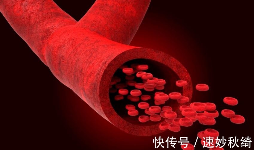 玉米|“甘油三酯天敌”就是它！中老年人群，为了血管健康尽量吃一些