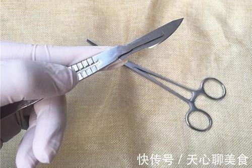 恶性肿瘤|得了癌症,该怎么治疗?医生给出了具体建议,少走点弯路