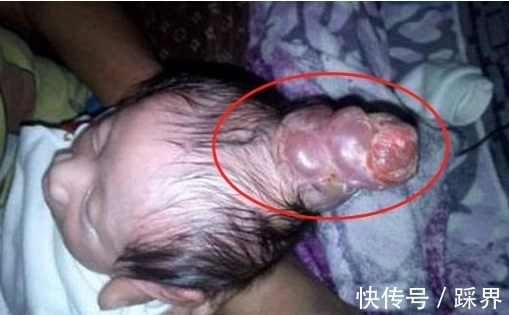 独角兽|奇闻;怀胎十月生下“独角兽”,得知检查结果后奔溃,结局暖心