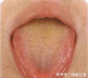 脾虚|10个人脾9个虚!脾虚的6大症状你有几个?长期脾虚的危害是什