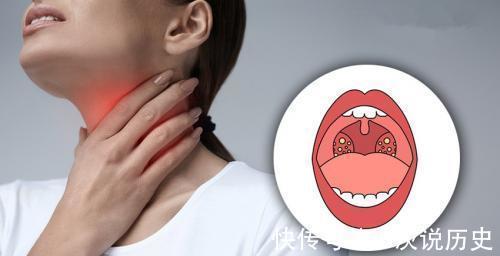 补充营养|身体露出3个“马脚”，或是甲状腺癌来“敲门”，别不当回事