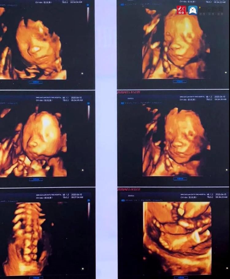 多幸运，当初选择的是你|莲池五周年征文展| 李孝堙