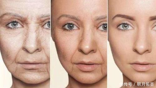 项目|我想祛除法令纹,医美的诸多项目,该如何选择?