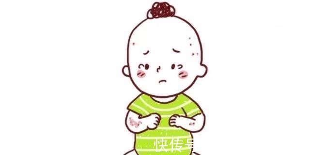 湿疹|出生几周的宝宝居然长痤疮千万别挤、别乱用药